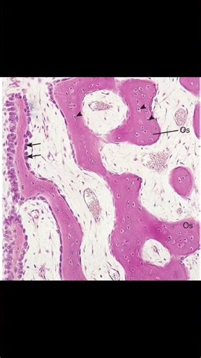 Light micrograph of intramembranous ossification (×132).