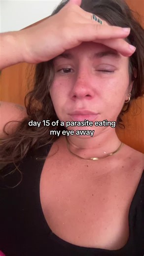 Day 15 of Eye Parasite Journey: My Story Revealed