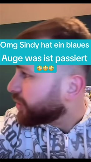 Sindy's Blue Eye Surprise on Live Stream