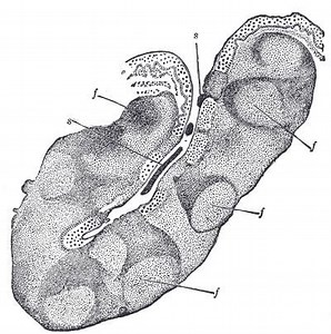 Tonsillar crypts - Alchetron, The Free Social Encyclopedia