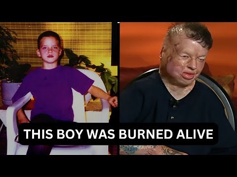 Robbie Middleton Named His Killer Before Dying After Being Burned Alive