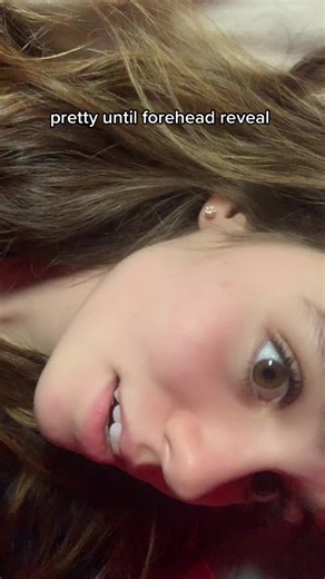 ib @Chloe Skelton #vectorsbowlcut #forehead #fivehead #bigforehead #fypシ