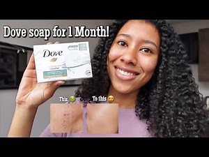 I Used Dove Soap on My Face Everyday For a Month!