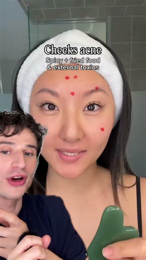 What your acne is telling you… #dermreacts #skincare #dermatologist #dermangelo