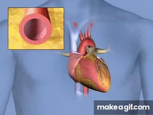 What is Shock? on Make a GIF