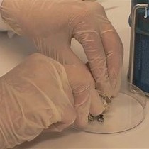 Video: Oral Biofilm Analysis of Palatal Expanders by Fluorescence In-Situ Hybridization and Confocal Laser Scanning Microscopy