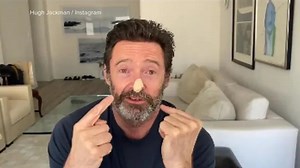 Hugh Jackman reveals results of skin cancer biopsies
