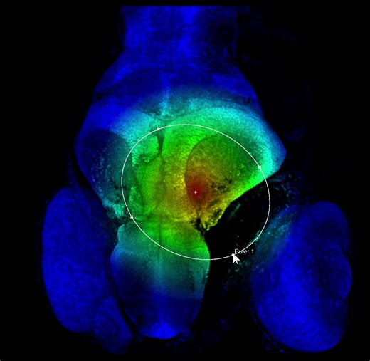 The radial gradient color map can now be controlled by ruler size | FluoRender