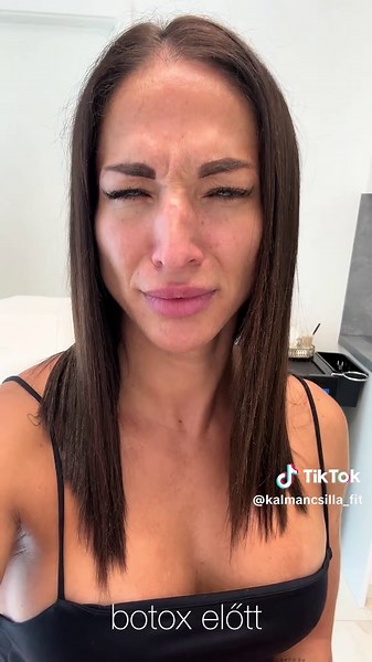 Botox és hialuron: Tudatos önápolás Győrben