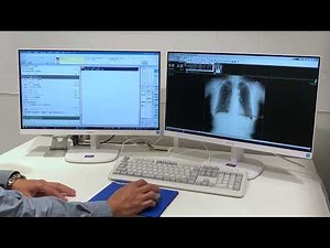 SoliPACS（PIXTERA社）－Medicom-HRｆ（電子カルテ）連携動画