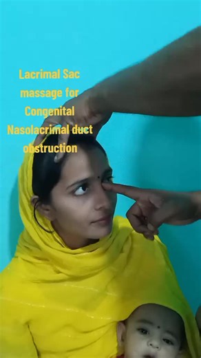 Lacrimal Sac Massage for Nasolacrimal Duct Obstruction