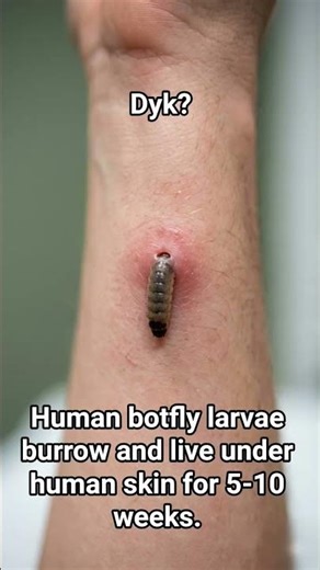 A fly that lives on human skin?🤯 #facts #flies #shorts #viralshort