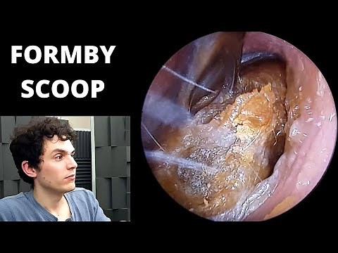 Formby Scoop Used To Extract Hard Wax From Small Ear