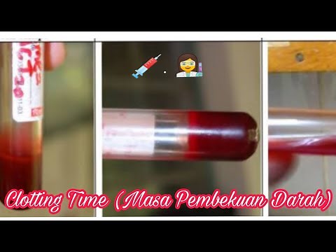 PEMERIKSAAN CLOTTING TIME (CT) MASA PEMBEKUAN DARAH!! Analis Kesehatan