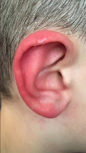 Why our ears got red hot sometimes? #facts #youtubeshorts #humanbody
