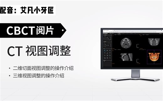 口腔医学CBCT教学之Ct视图调整