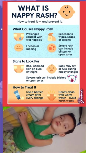How to treat Nappy Rash and Prevent it? #ctto #guidelines #fblifestyle | Momshie Jhane Alcos