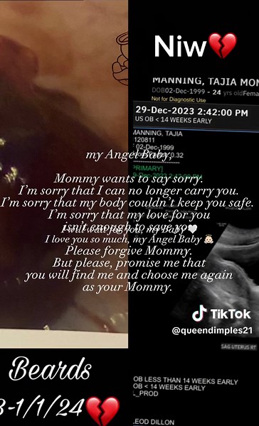 On 1/1/24 i lost my 2nd child to a eptopic pregnancy where i had to lose my right fallopian tube and it’s really taking a toll on me 💔😔 rip mommy baby Niw Beards #misscarriageawareness #depresion #eptopicpregnancysurvivor #สปีดสโลว์ #สโลว์สมูท #สปีดสโลว์ #สโลว์สมูท