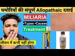 घमोरियों का कारण और एलोपैथिक इलाज | Miliaria Types, Causes & Treatment In Hindi | Deepak Pharmacy