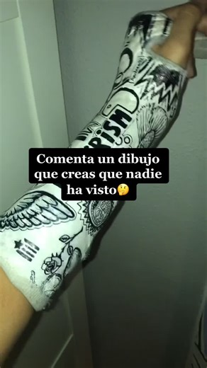 Arte en Yeso: Dibujos Creativos en Brazo Fracturado