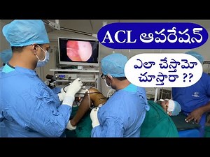 ACL ligament reconstruction surgery technique | Telugu | Dr Ramprasad kancherla