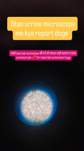 mltstudent | Urrine microscopy | Instagram