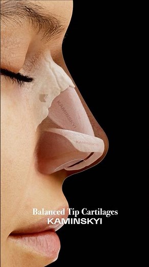 Balanced Tip Cartilages ⭕️ KAMINSKYI