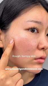 4.9K reactions · 695 shares | ✨ Piel radiante, tono uniforme. Descubre el poder del dúo iluminador: Niacinamida al 10% + Ácido Tranexámico al 4%. Este suero de ANUA reduce manchas, controla el exceso de sebo y mejora visiblemente la textura de la piel.  Apto para todo tipo de piel |  Ideal para usar de noche cómpralo en www.beautyandmimosas.com #Anua #Niacinamide #AcidoTranexamico #SkincareCoreano #RutinaFacial #GlowUp #PielSaludable | Beauty and Mimosas | Facebook