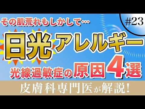 【日光アレルギー】光線過敏症の原因４選を皮膚科専門医が紹介