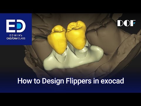 How to Design a Flipper in exocad