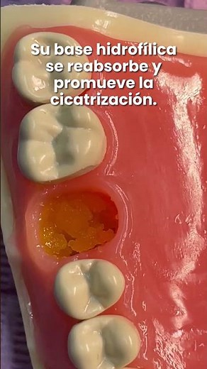 Para ti que sabes lo que es una alveolitis... 🦷