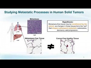 Rosandra Kaplan: Spatially Exploring the Microenvironment of the Pre-metastatic Niche