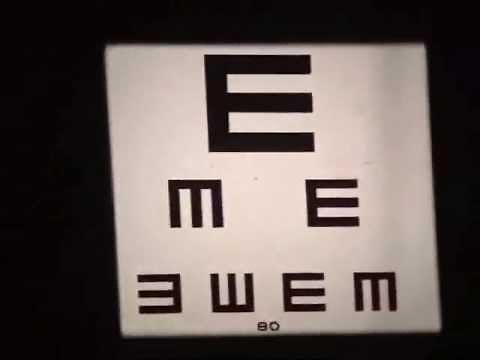 Tumbling E's Visual Acuity