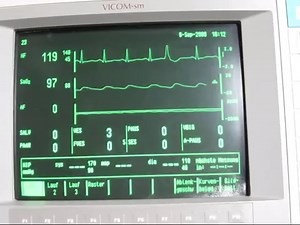 心电监护仪氧饱和度低报警