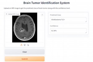 Brain Tumor Identification System