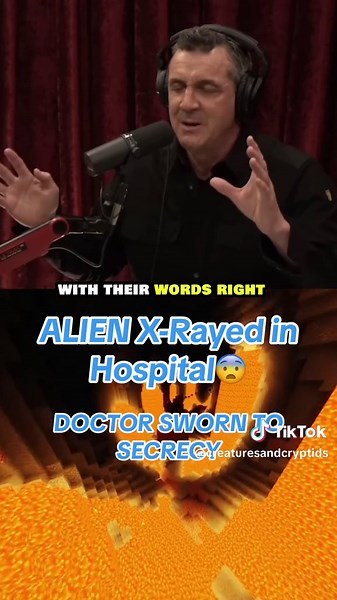 The Varginha Alien Incident of 1996: Shocking X-Ray Discovery