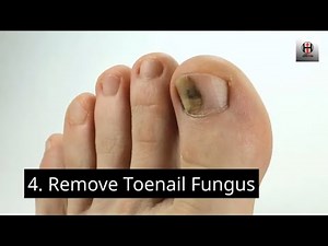 7 Amazing Usage Of Hydrogen Peroxide