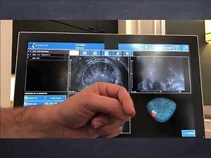 Les biopsies de prostate ciblées : qu'est ce que c'est ?