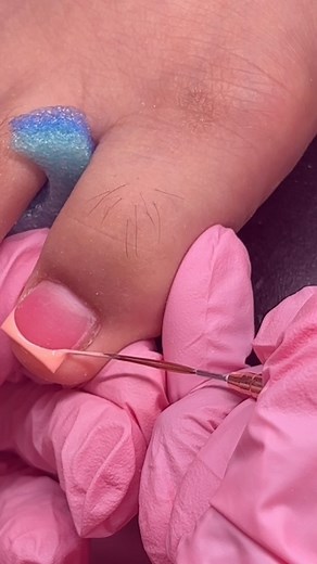 5.5K views · 24 reactions | There’s something so satisfying about a crisp French tip on the big toe 奈 I could do this all day. Want to learn how I get it this clean? My eBook is packed with all my tips and real-time demos. Link in bio  #FungalReconstruction #FrenchTipToes #NailTechContent #explorepage #nailsnailsnails #toebbl | Nailzbybalbi | Facebook