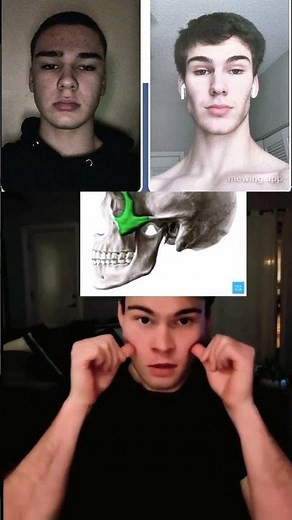 Correct Way of Mewing & Zygo Pushing Tutorial | Mewing Exercise for Jawline #Shorts