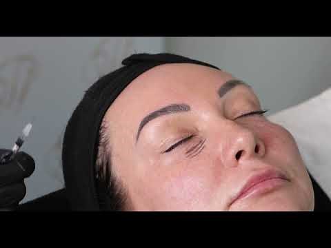 OFFICIAL iLLUMA Luna Micro Heal Technique