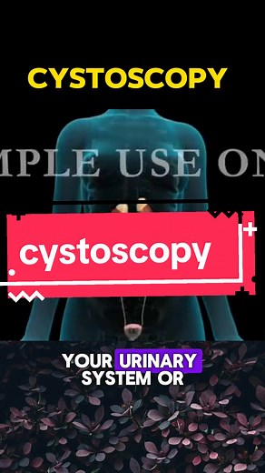 cystoscopy and its procedure follow for more medical knowledge #medstudent #medicalknowledge #medicineexplained #cystoscopy #disease #unfreeezmyacount #medicinestudent #foryou #viral @Dr.Graves @Doctor Mike