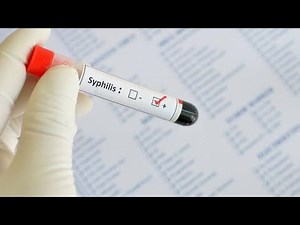 VDRL for Syphilis; Venereal Disease Research Laboratory test screening tool