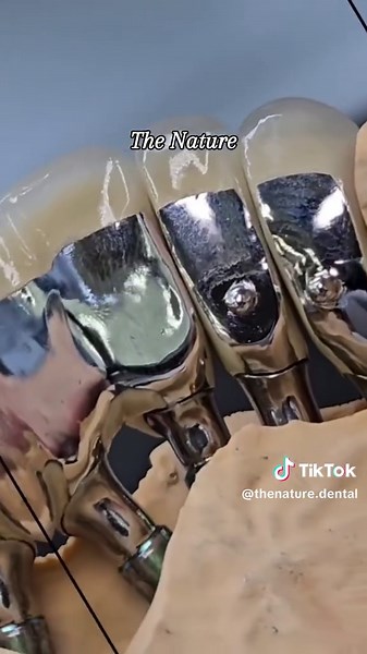 Understanding AQN Zirconia Crowns for Front Teeth