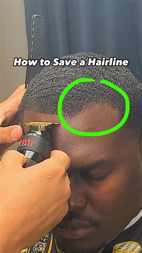 How to Save a Hairline💈 - Analyzing the hairline before you start cutting is crucial. Visualize the most natural, symmetrical pattern and begin to etch it out. - You can take hair off, but you can’t put it back on, so take your time. Share this video with someone who could use it. #thomascutit #barbervideos #barbershop #barberclips #mississippibarber #barberstyledirectory #barberstyle #mensgrooming #barbering #haircut #barbervideos #barberclips #hairline #hairlinetips #recedinghairline #thinnin