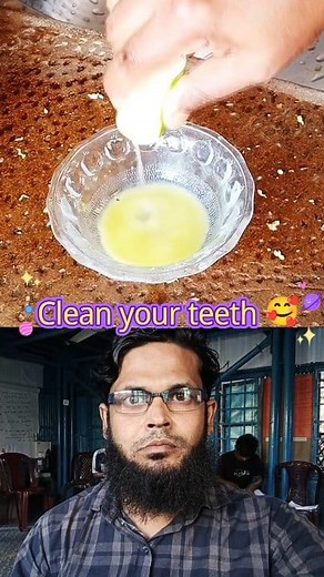 453K views · 5.7K reactions | ✅ Clean Your Teeth Naturally with Simple Daily Habits  #clean #teeth #naturally #simple #dailylife #habits | Azim ullah 2 | Facebook