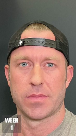 100 Day Beard Growth Timelapse Journey