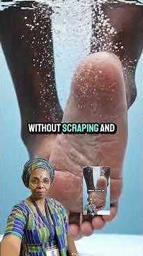 Why Some People Soak Their Feet in Hydrogen Peroxide.