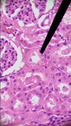 TIPS for DISTINGUISHING a DISTAL from a PROXIMAL convoluted tubule under a microscope! #histology...