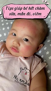 4.5K views · 15 reactions | Tips dành cho bé bị chàm sữa, mẩn đỏ, viêm da,...mẹ nên biết. Cách dùng bộ đôi kem chàm sữa, dưỡng ẩm Kutieskin hiệu quả hơn, các mom đặt hàng ngay nhận ưu đãi ạ 殺殺 | Kutieskin | Facebook